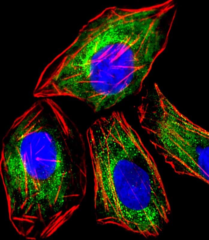 IHC-plus™ RAB3A Antibody (clone 1531CT562.14.57)
