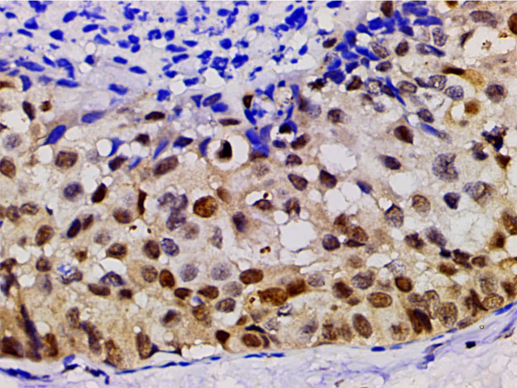 LIMK1 / LIMK Antibody (phospho-Thr508)