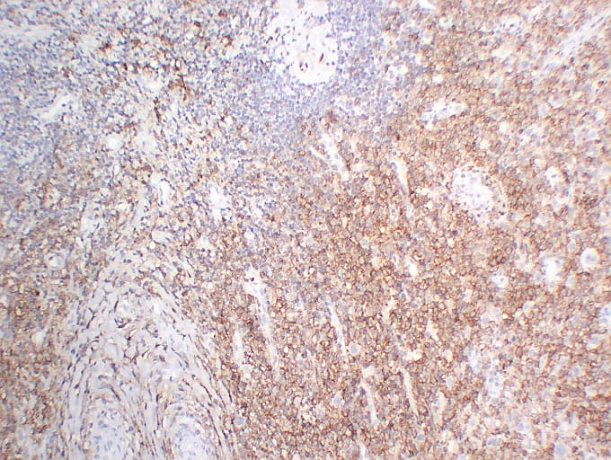 CD3E Antibody (clone ABT-CD3)