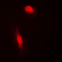Polyclonal Rabbit anti-Human COPS3 / CSN3 Antibody (Internal, IHC, IF, WB)