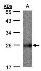 UQCRFS1 Antibody (aa1-274)