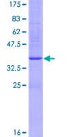 Human ADAM33 Protein (Recombinant GST)