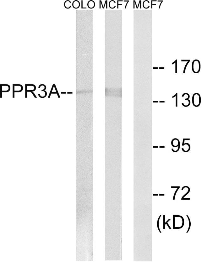 Polyclonal Rabbit anti-Human PPP1R3A / GM Antibody (WB)