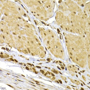 S100A4 / FSP1 Antibody