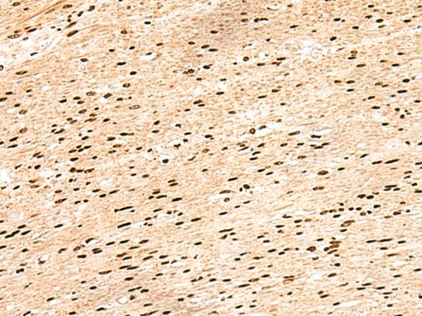 HIST1H1E Antibody