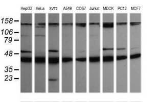 MAP2K1 / MKK1 / MEK1 Antibody (clone OTI2B2, Carrier-free)