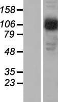 AP2B1 Protein (Over-Expression Lysate Myc-DDK (Flag))