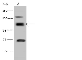 RABEP1 / Rabaptin-5 Antibody