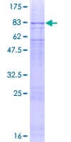 Human PLRG1 Protein (Recombinant GST)