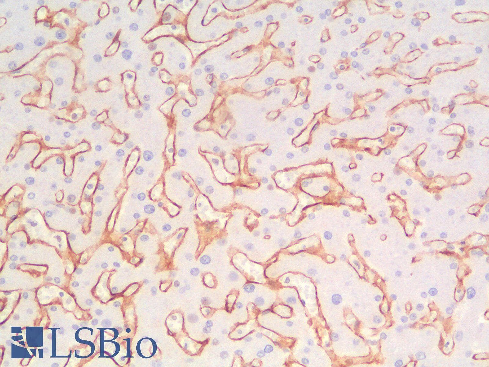 PathPlus™ Collagen IV Antibody (Concentrated)