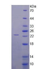 Human COL16A1 Protein (Recombinant His-T7)