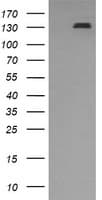PDGFRB / PDGFR Beta Antibody (clone OTI1G9)