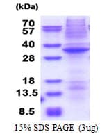Human DRAK1 / STK17A Protein (Recombinant His)