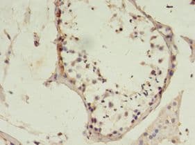 MSH6 Antibody (aa1-400)