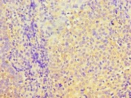 PDHX / Protein X / ProX Antibody (aa1-300)