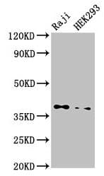 Polyclonal Rabbit anti-Human PPP1CB Antibody (IHC, WB)