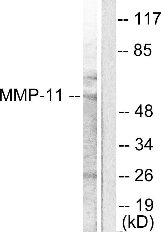 IHC-plus™ Polyclonal Rabbit anti-Human MMP11 Antibody (aa61-110, IHC, IF, WB)