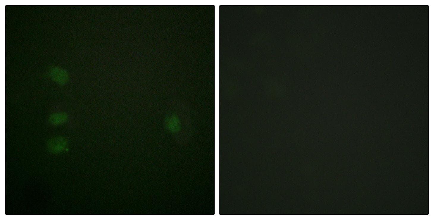 NPM1 / NPM / Nucleophosmin Antibody (p199)