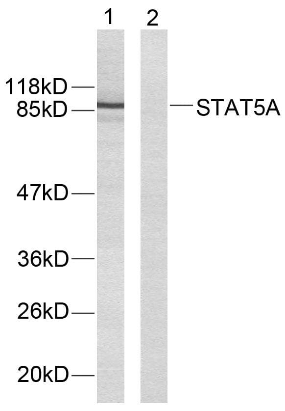 STAT5A Antibody (p694)