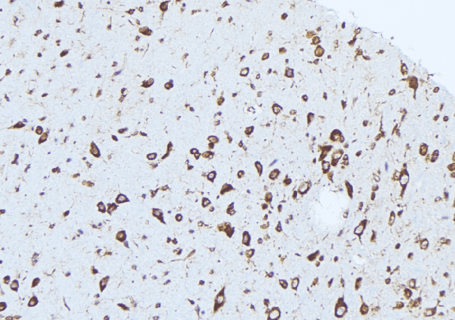 CASP1 / Caspase 1 Antibody
