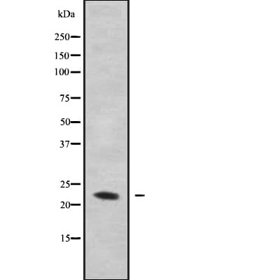 PMP22 Antibody