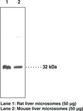 IHC-plus™ Polyclonal Rabbit anti-Human HSD11B1 / HSD11B Antibody (aa77-92, IHC, WB)