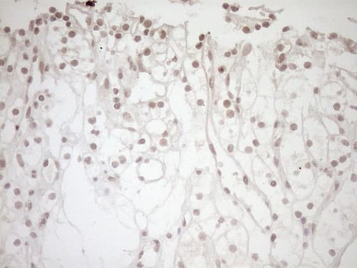 NR1I3 / CAR Antibody (aa1-236, clone OTI10B1)