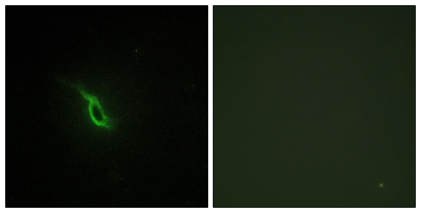 IHC-plus™ Polyclonal Rabbit anti-Human ADRA2A Antibody (aa331-380, IHC, IF, WB)