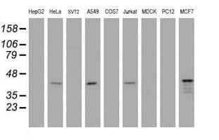 PRR11 Antibody (aa125-360, clone OTI3C8)