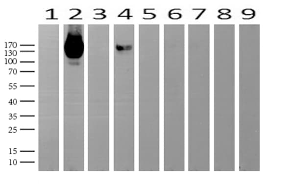 NCAM / CD56 Antibody (aa20-718, clone UMAB194)