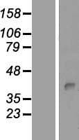 Human PKDCC / SGK493 Protein (Over-Expression Lysate Myc-DDK (Flag))