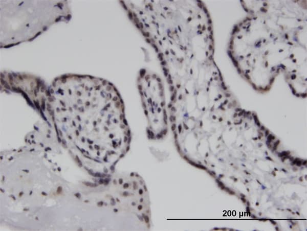 IFIH1 / MDA5 Antibody (clone 3F6)