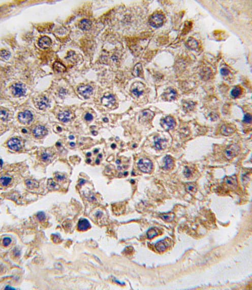 MTOR Antibody (Ser2481)