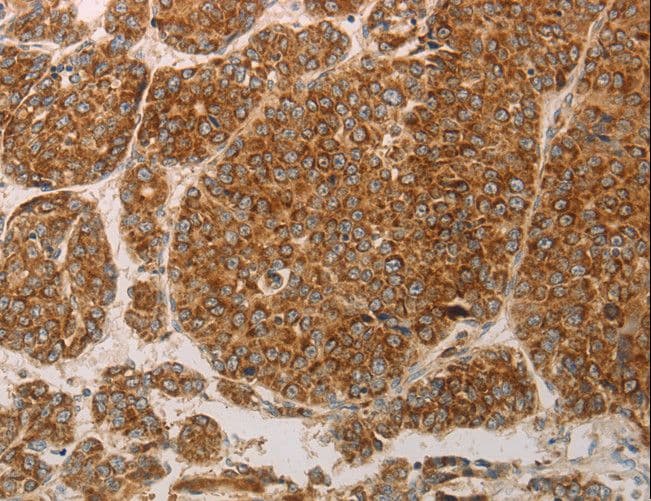PRDX3 / Peroxiredoxin 3 Antibody