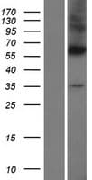 DPAGT2 / DPAGT1 Protein (Over-Expression Lysate Myc-DDK (Flag))