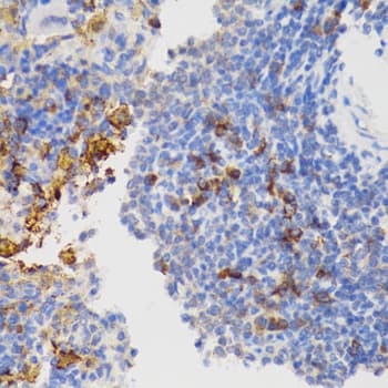 PTPN11 / SHP-2 / NS1 Antibody