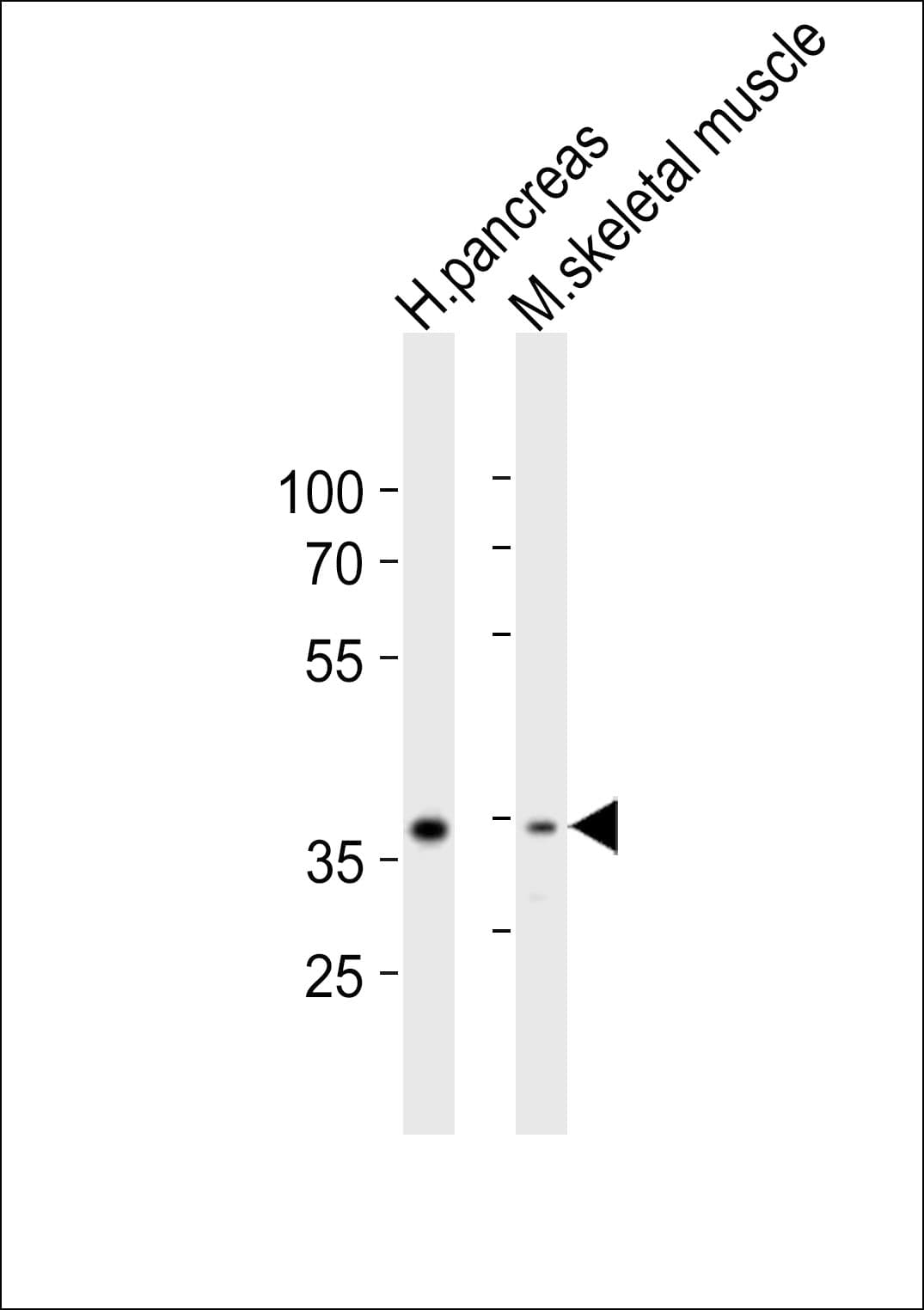B4GALT7 Antibody (aa256-290)