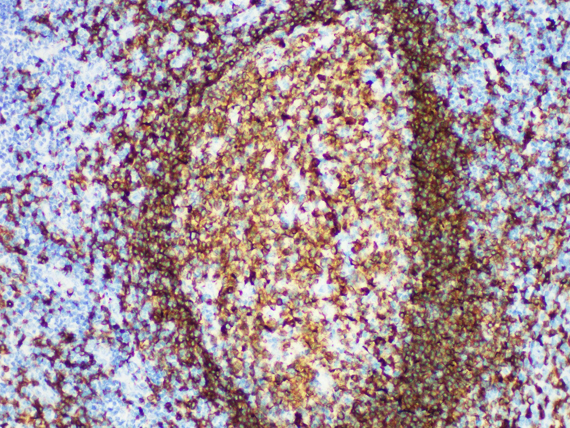 CD79A / CD79 Alpha Antibody