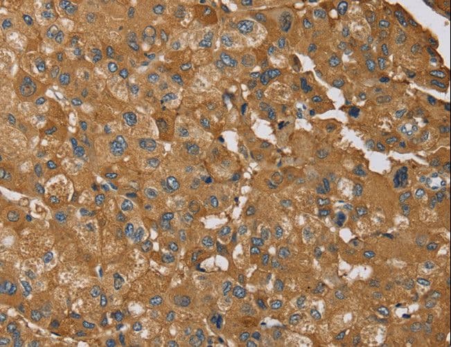 Polyclonal Rabbit anti-Human RMA1 / RNF5 Antibody (IHC, WB)