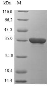 Epstein-Barr Virus EBV EBNA-1 Protein (Recombinant 6His-SUMO, N-terminus)