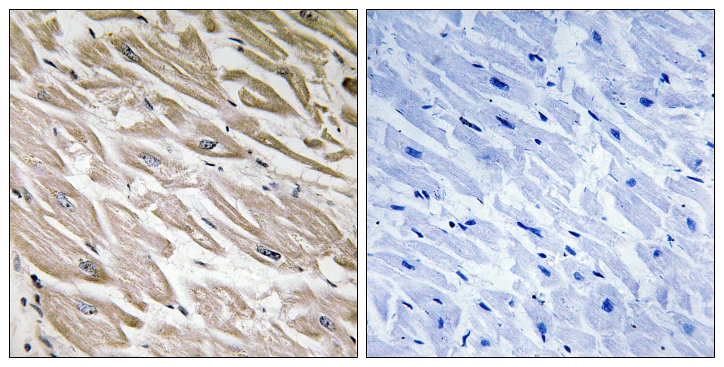 IPP2 / PPP1R2 Antibody (phospho-Ser120)