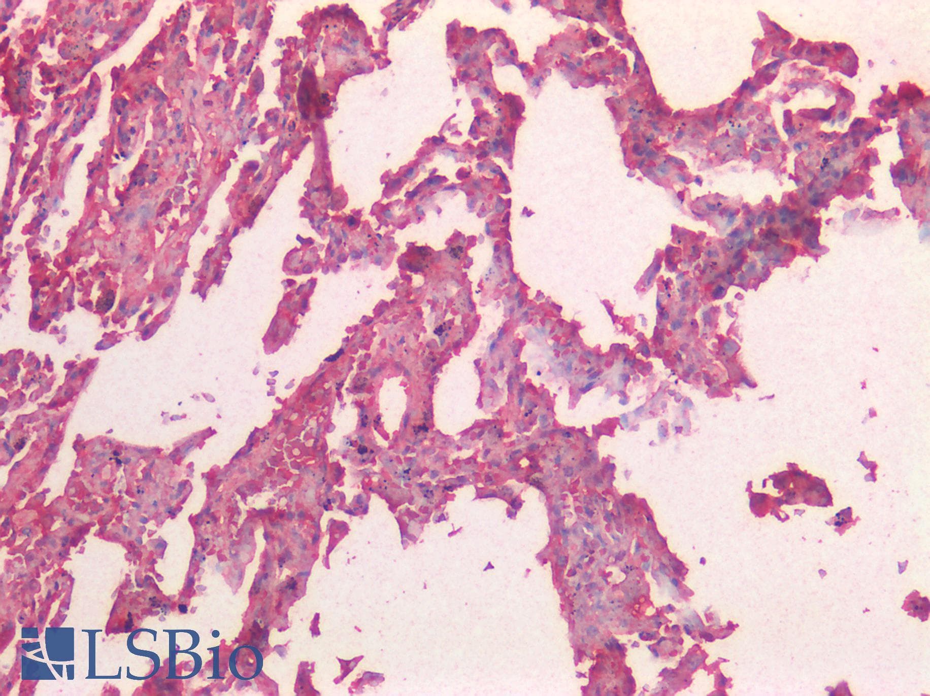 IHC-plus™ Monoclonal Mouse anti-Human TREM2 / TREM-2 Antibody (clone 08, Preservative Free, IHC)