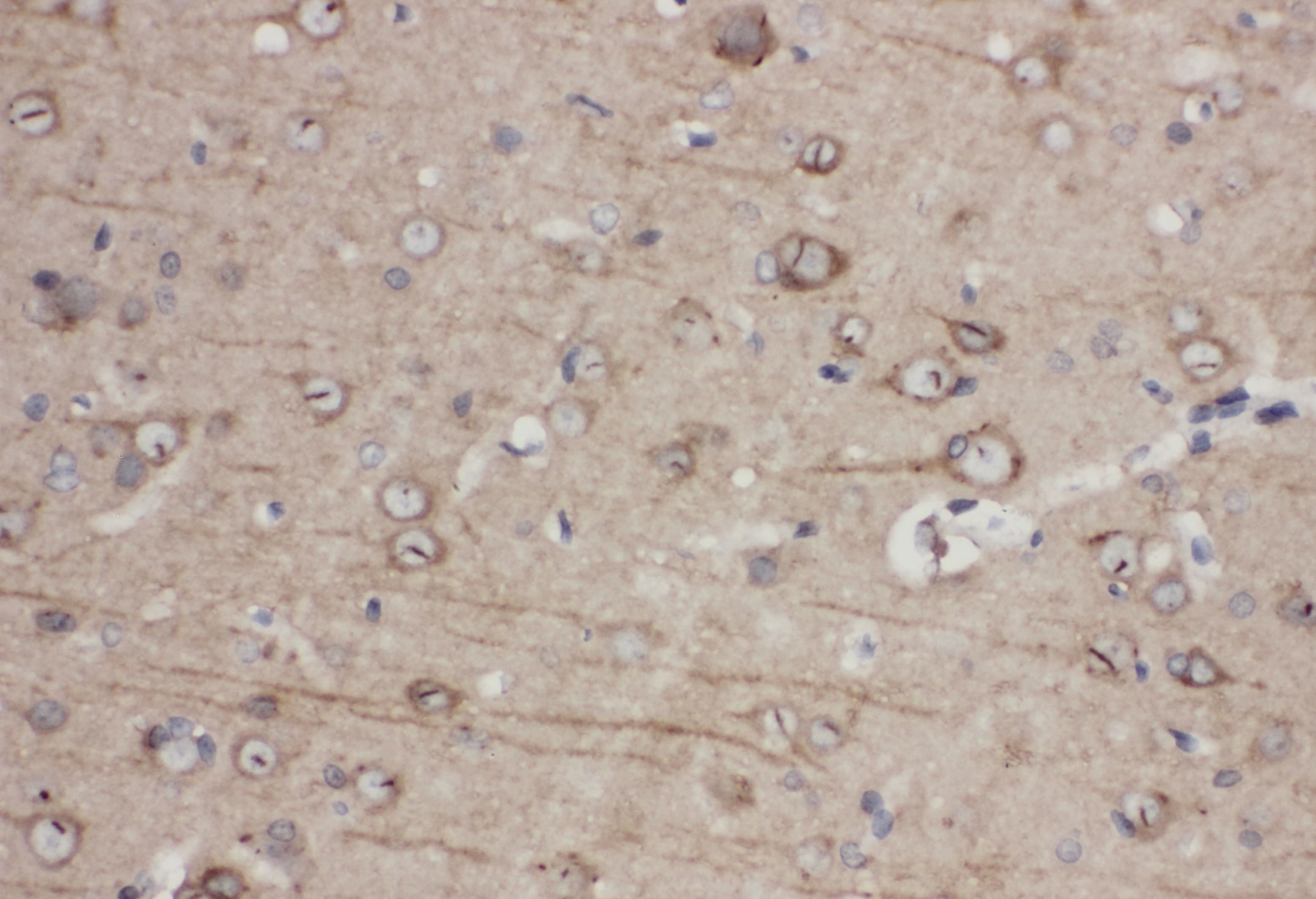 Polyclonal Rabbit anti-Human EPHA1 / EPH Receptor A1 Antibody (aa963-976, IHC, WB)
