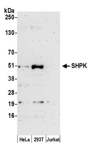 SHPK / CARKL Antibody (aa1-50)