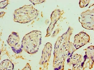 IL1R1 Antibody (aa18-320)