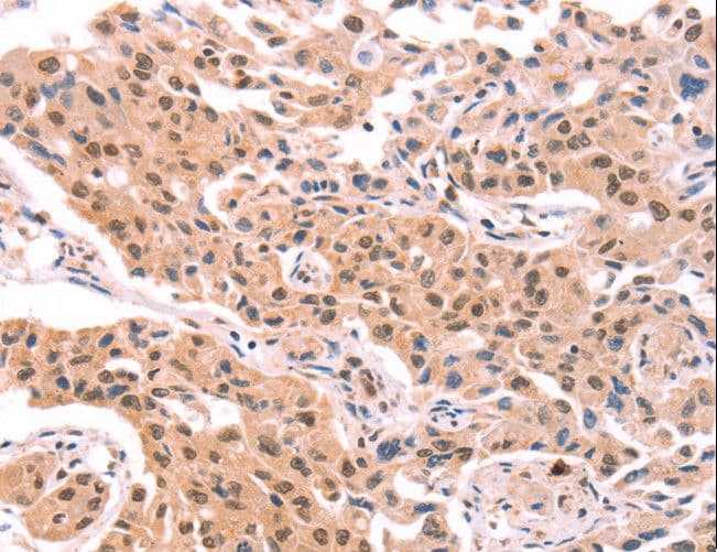 Polyclonal Rabbit anti-Human PROS1 / Protein S Antibody (IHC)