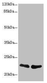 Polyclonal Rabbit anti-Human TNFAIP8 / SCC-S2 Antibody (IHC, WB)