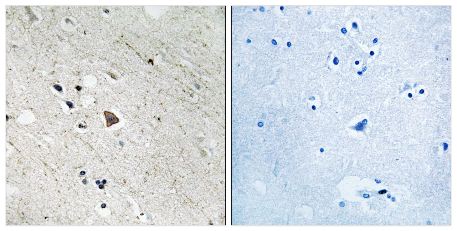 Polyclonal Rabbit anti-Human CD135 / FLT3 Antibody (phospho-Tyr969, IHC, WB)