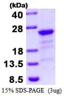 Human HBXIP Protein (Recombinant His)