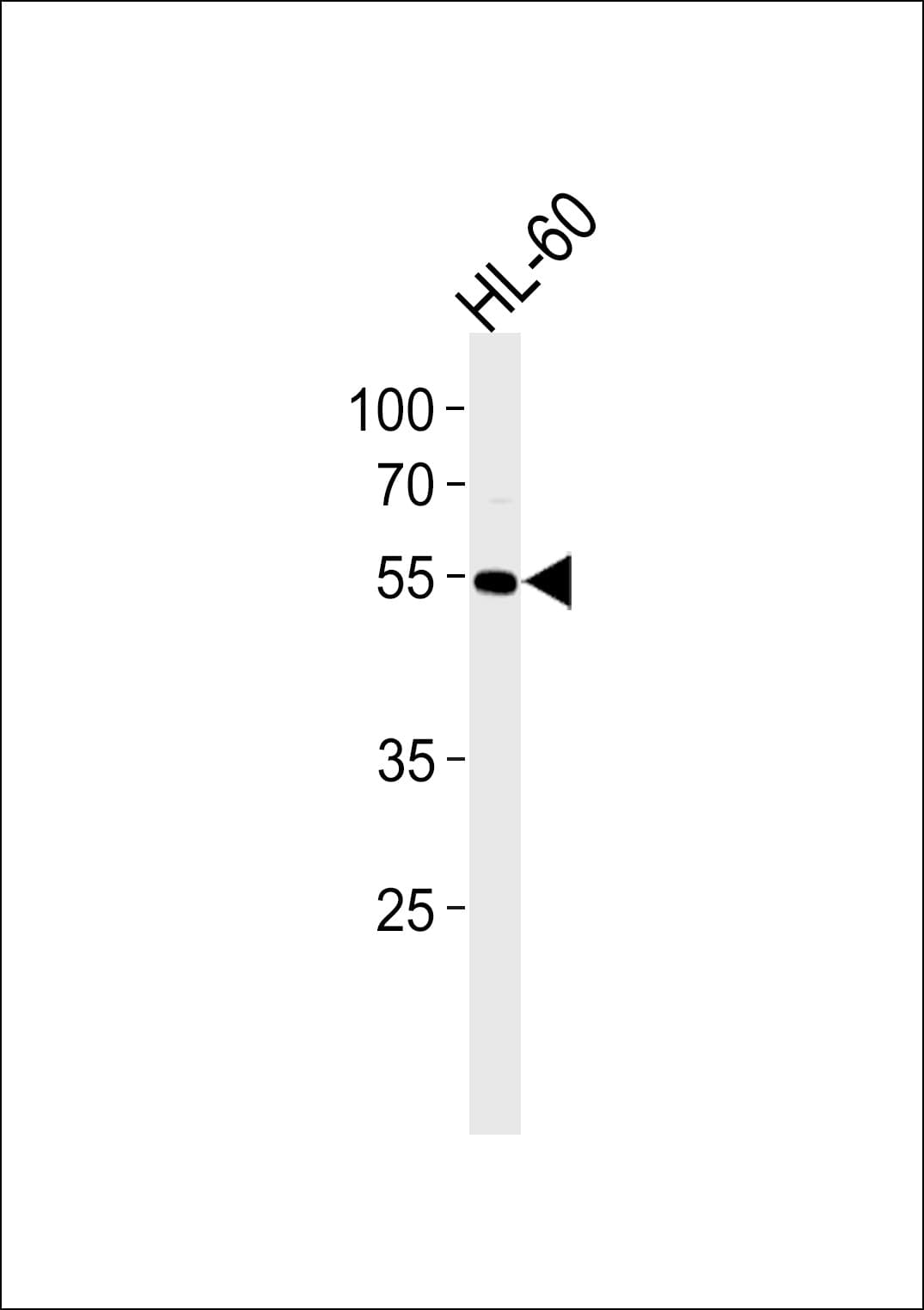 Monoclonal Mouse anti-Human AKT1 Antibody (clone 960CT4.5.1, WB)